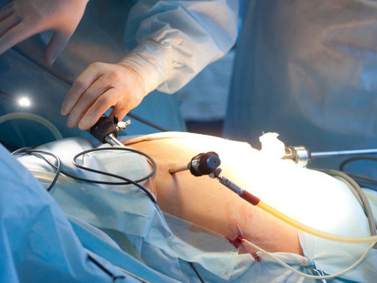 best Nisha Ohri Laparoscopic Surgeon in Delhi